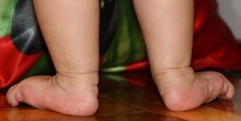 Déformation