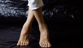 Déformation de Valgo
